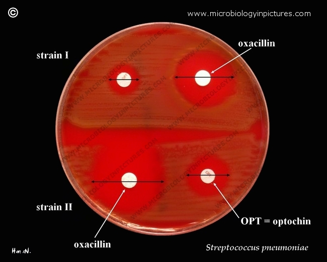 positive optochin test result,susceptibility to penicillin